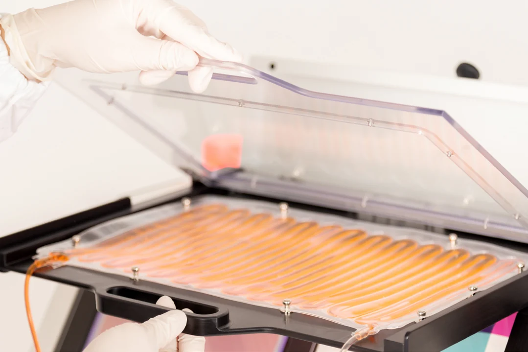 The treatment bag lying flat in the Lumilight tray, filled with the patient's cells