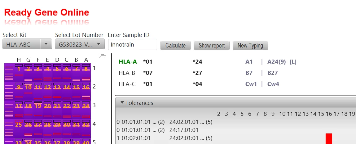 Ready Gene Online: kit selection, gel interface and tolerance display